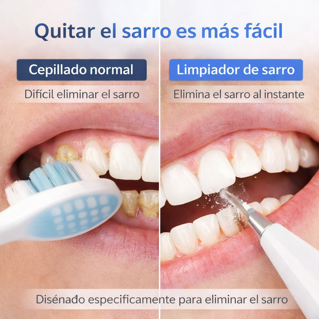 Limpiador dental quita sarro